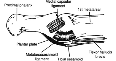 How Do you Fix a Turf Toe?