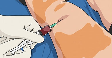 When is a Knee Aspiration Necessary?